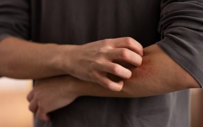 Dermatologist for Eczema
